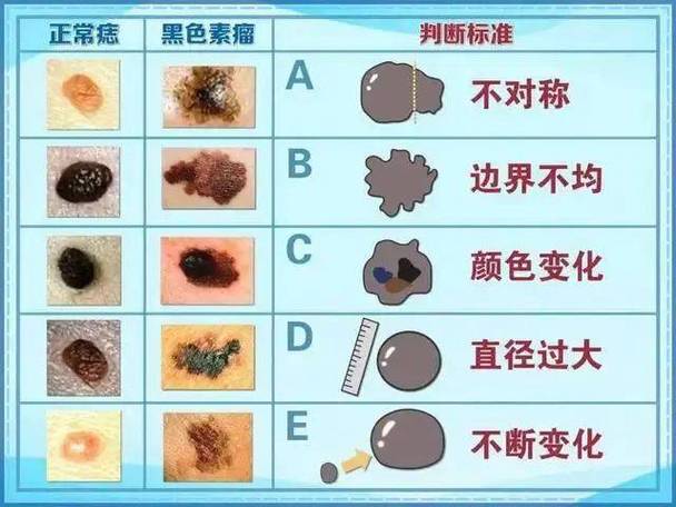 临泉哪里看皮肤科好 (临泉哪里看皮肤科好 临泉哪家医院治皮肤病好)